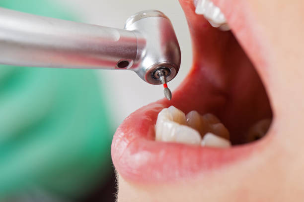 Best Cracked Tooth Emergency Dentist  in Monteagle, TN